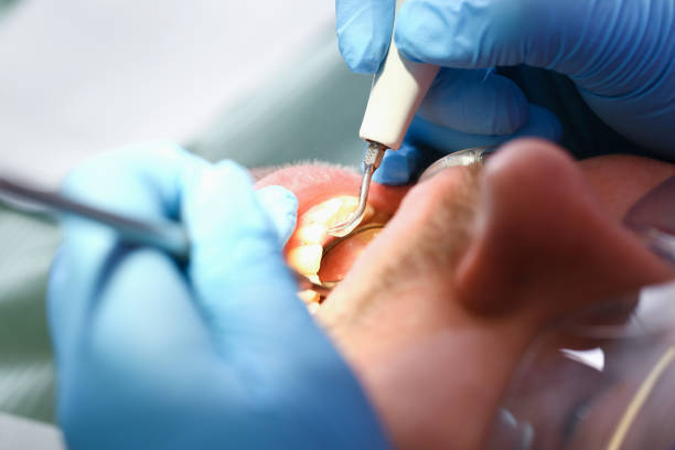 Best Weekend Emergency Dentist in Goshen, IN