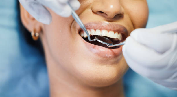 Best Emergency Gum Treatment in Goshen, IN